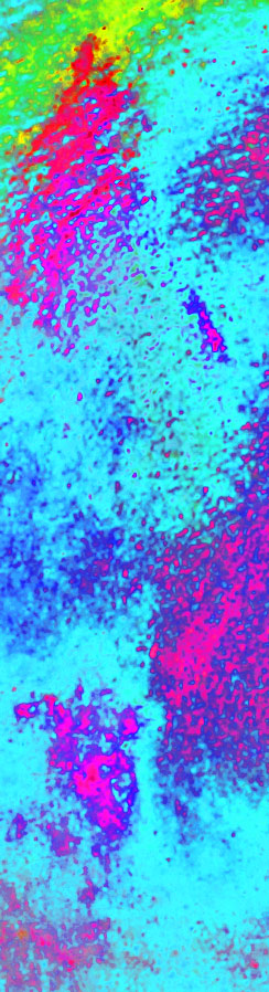 Zahnnschmerzen nach Implantat